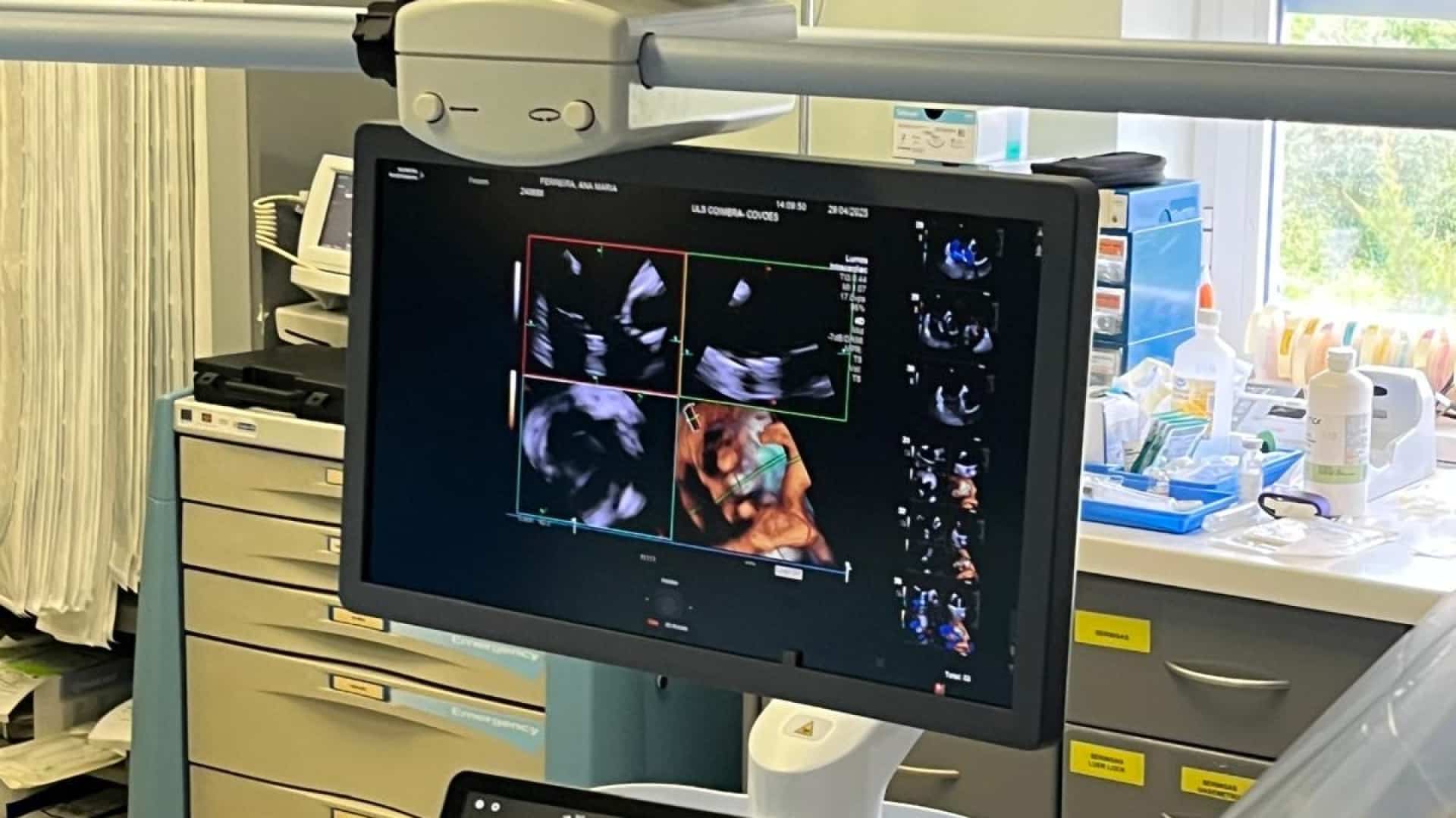 Innovant. ULS de Coimbra effectue des procédures avec échographie 4D