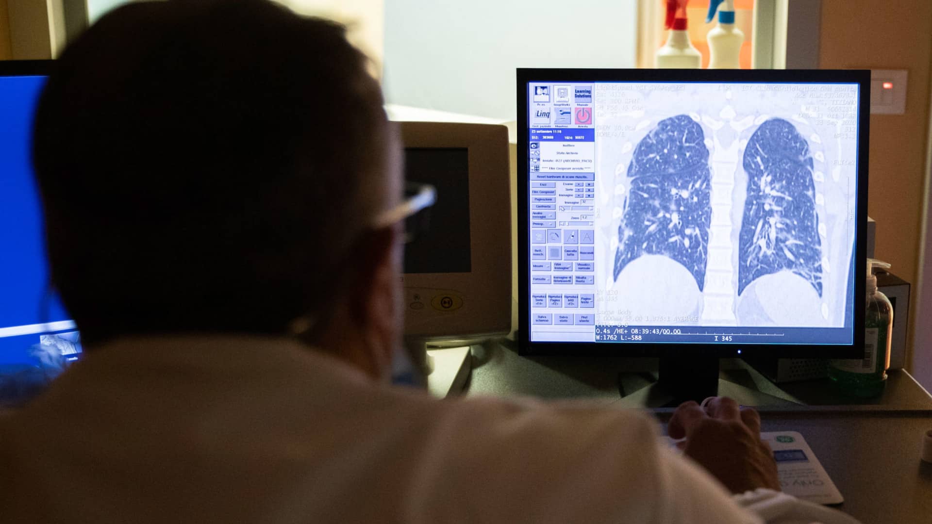 Il y a un "manque de volonté politique dans le dépistage" du cancer du poumon.