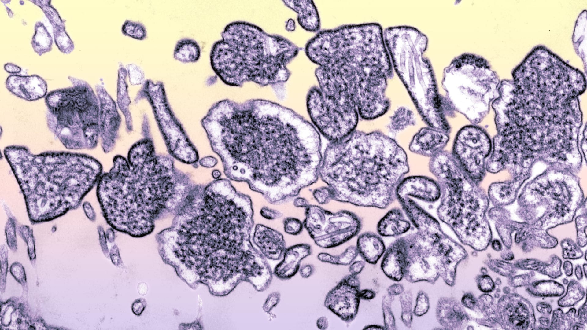 Nanocorps découvert capable de neutraliser les virus mortels Hendra et Nipah.