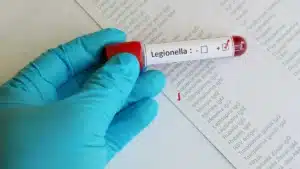 Suspicions de Legionella 'ferment' les piscines municipales à Maia