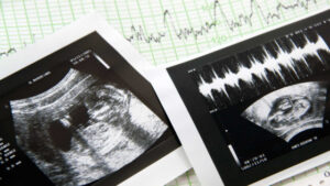 IGAS ouvre une procédure contre une clinique qui n'a pas détecté une malformation grave chez un fœtus.