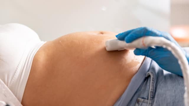 Mulher acusa clínica de Setúbal de não detetar perna incompleta a feto