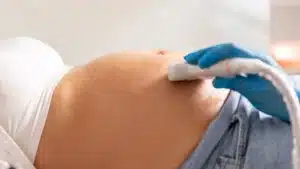 Une femme accuse une clinique de Setúbal de ne pas avoir détecté une jambe incomplète chez le fœtus.