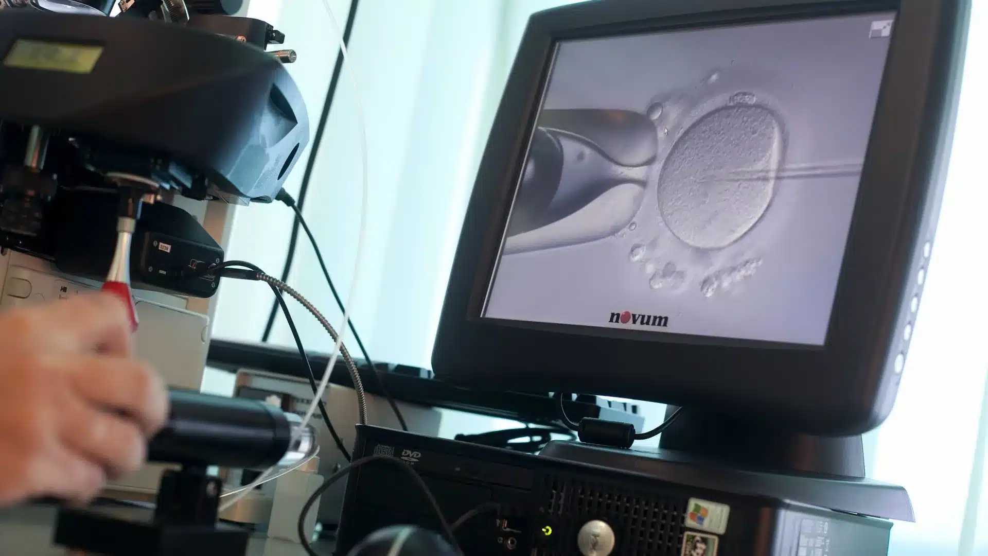 Deux sur trois premières consultations pour insémination dépassent le délai maximum.