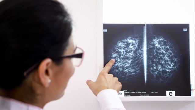 Diminution des cas de cancer en 2022 ? La Ligue avertit que les chiffres vont augmenter.