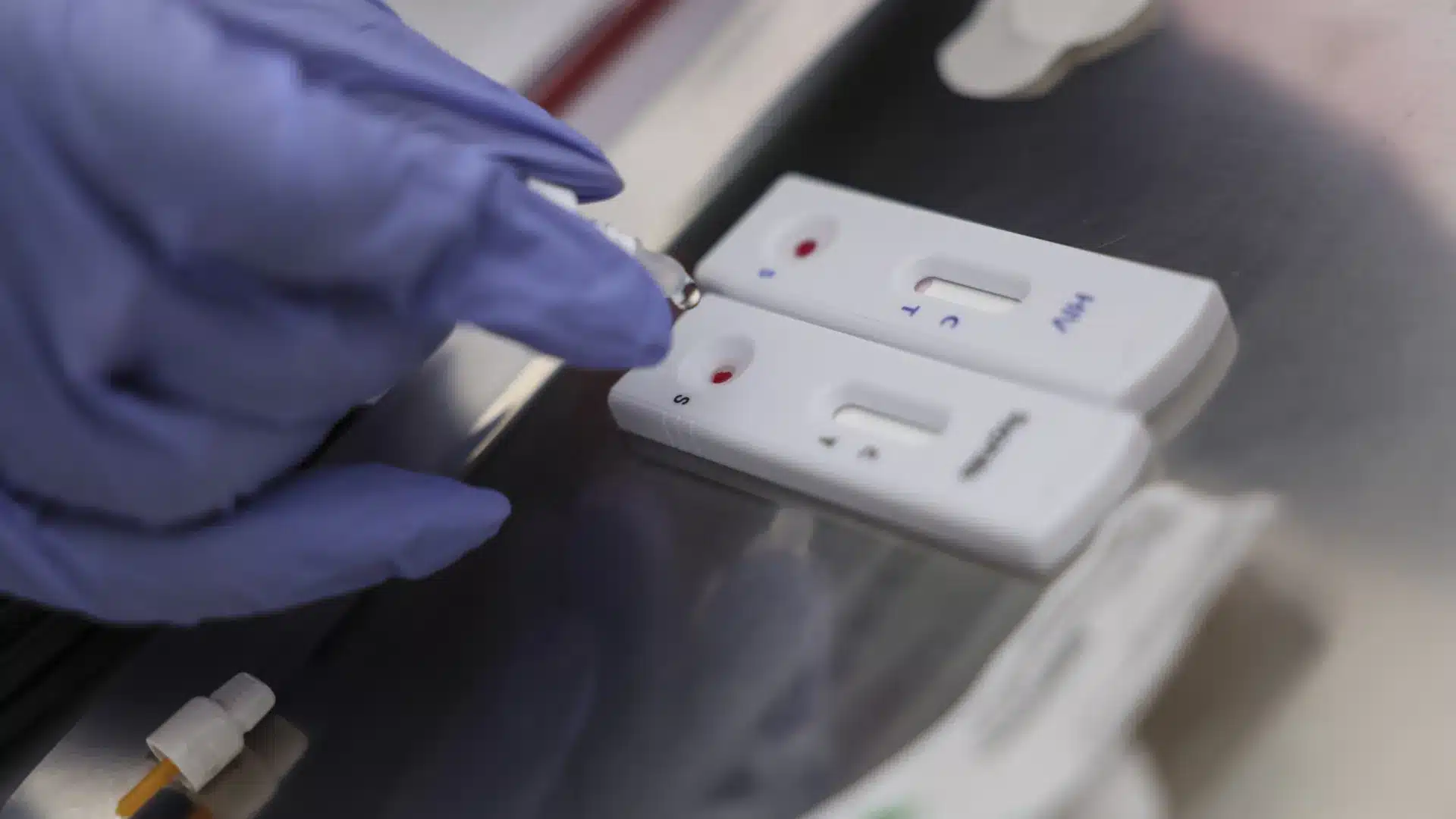 Moins de cas de VIH au Portugal, mais la majorité des diagnostics a été tardive.