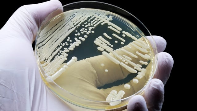Après tout, le 1er cas de Candida auris au Portugal a été identifié en 2022.