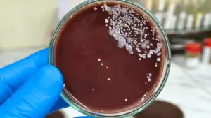 Menace. Premiers cas de 'Candida auris' identifiés au Portugal