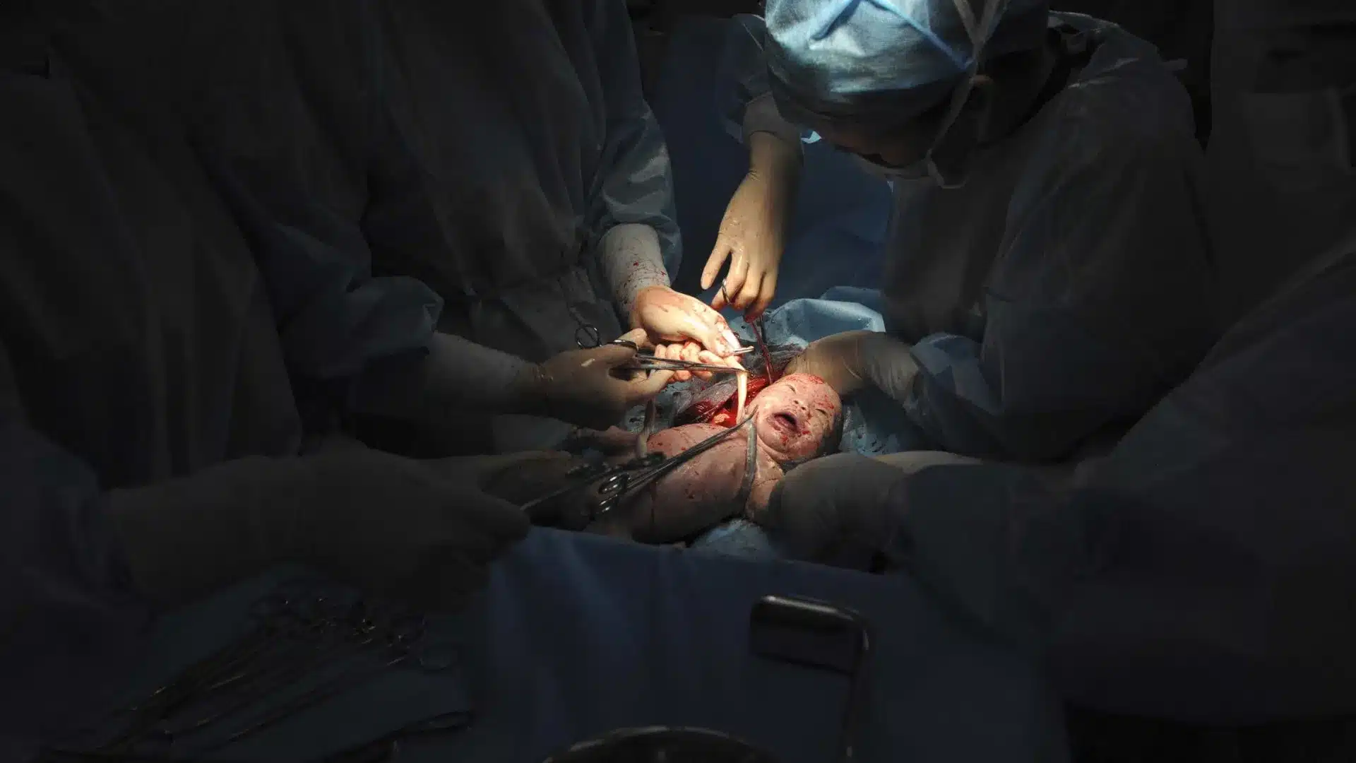 ULS de Coimbra augmente le nombre d'accouchements et dépasse les 5 100 en 2025.