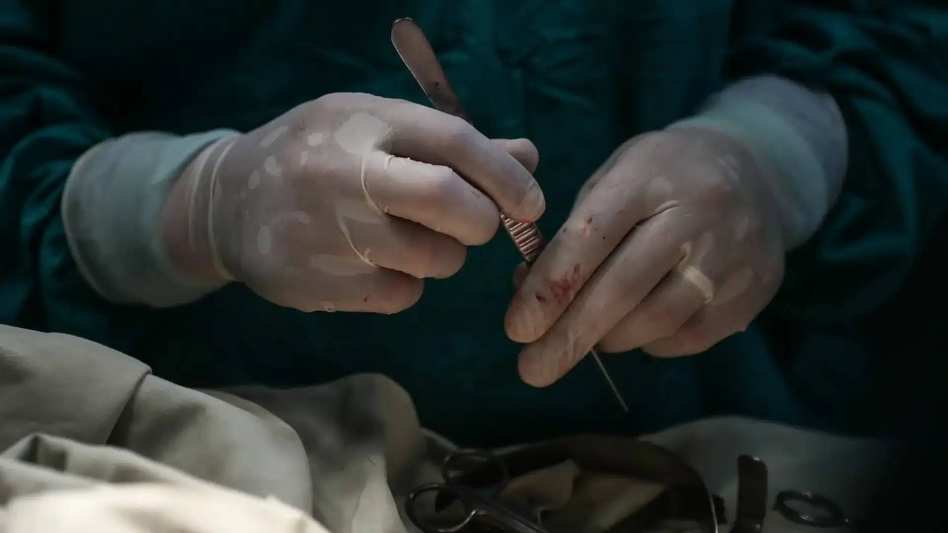 ERS enquête sur les contraintes d'accès à la chirurgie cardiaque