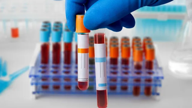 La PJ détient un technicien de laboratoire pour des soupçons de contamination. L'IPST a dénoncé.