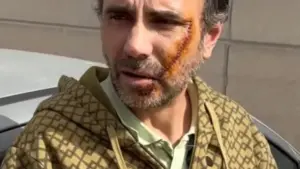 Un Portugais poignardé en Espagne par un repris de justice. Il est resté défiguré.