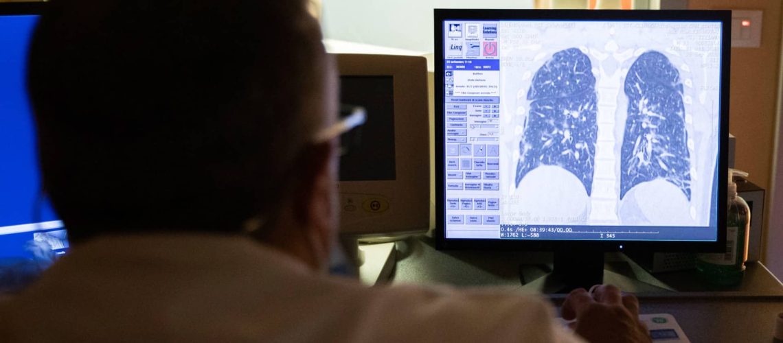 Il y a un "manque de volonté politique dans le dépistage" du cancer du poumon.