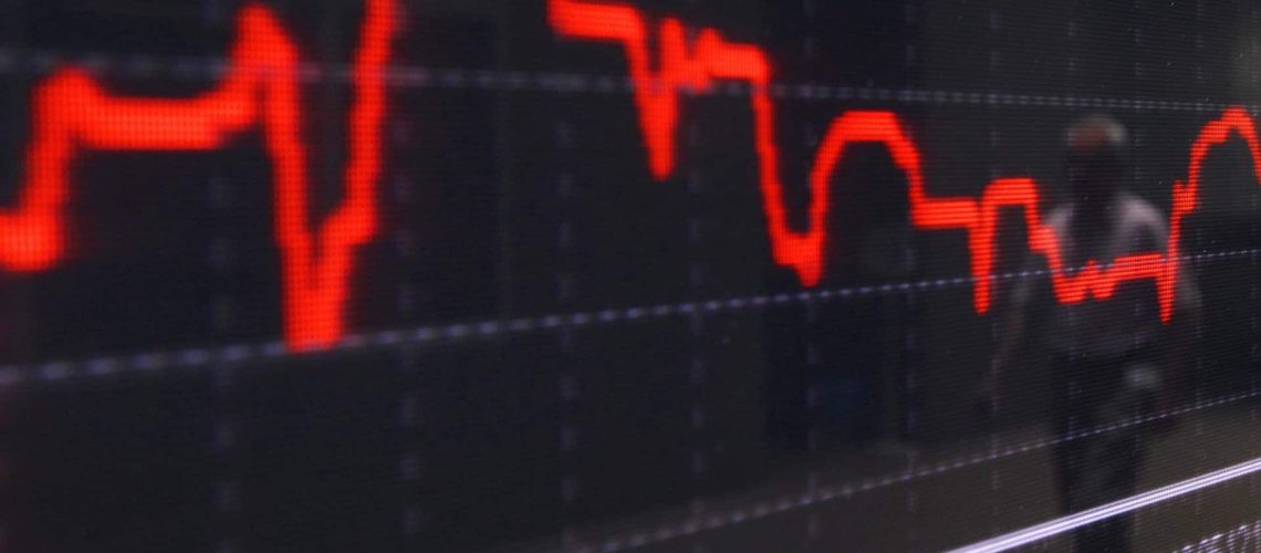 La Bourse de Tokyo ouvre avec le Nikkei en baisse de 0,5%.